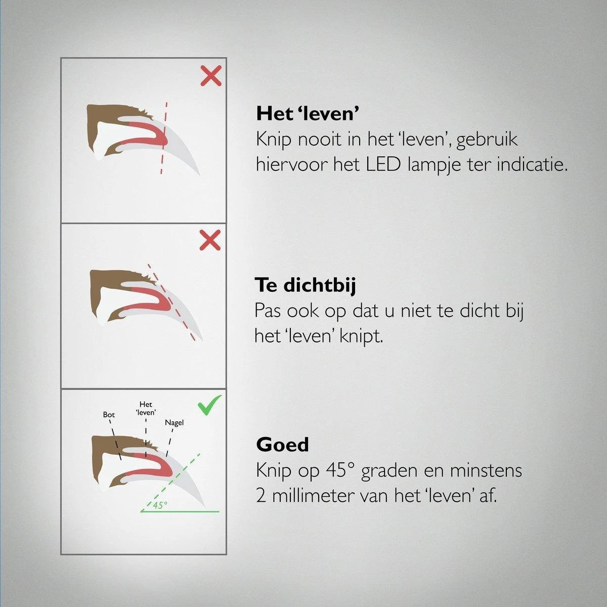 PETKIT® Professionele Dieren Nagelknipper - Nagelknipper Hond - Met LED - Met Vijl - Nageltang 10 PETKIT® Professionele Dieren Nagelknipper - Nagelknipper Hond - Met LED - Met Vijl - Nageltang - Afbeelding 8